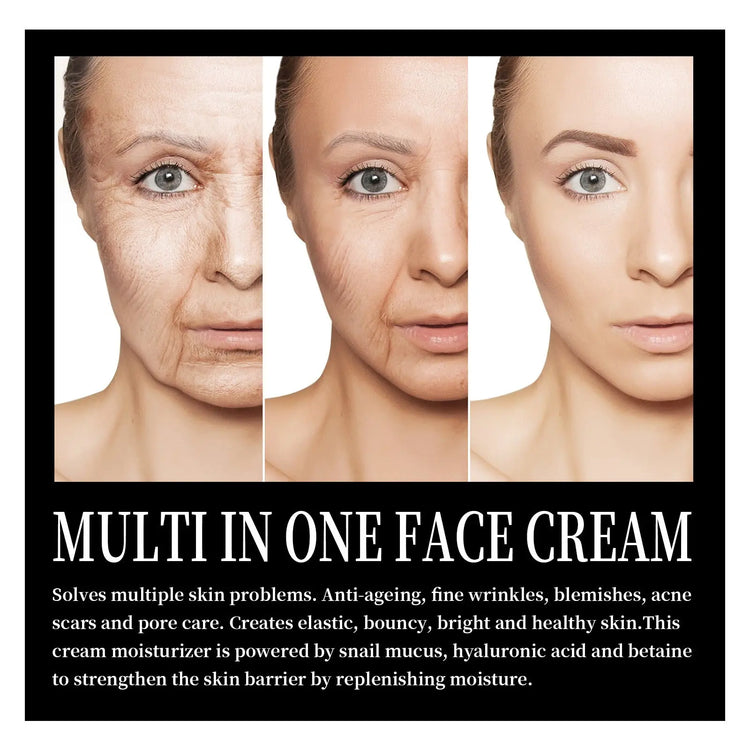 Snail Cream Fading Wrinkle French Lines Replenishment Firming Skin Anti-Aging - Huy&