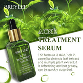BREYLEE Acne Treatment Serum Face Facial Anti Acne Scar Removal Cream Skin Care Whitening Repair Pimple Remover For Acne - Huy&