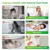 Detox Foot Patch - Huy&