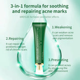 Acne Scar Removal Gel Tea Tree Qu Dou Printing - Huy&