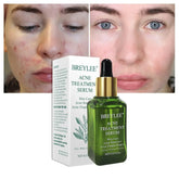 BREYLEE Acne Treatment Serum Face Facial Anti Acne Scar Removal Cream Skin Care Whitening Repair Pimple Remover For Acne - Huy&