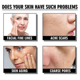 Snail Cream Fading Wrinkle French Lines Replenishment Firming Skin Anti-Aging - Huy&