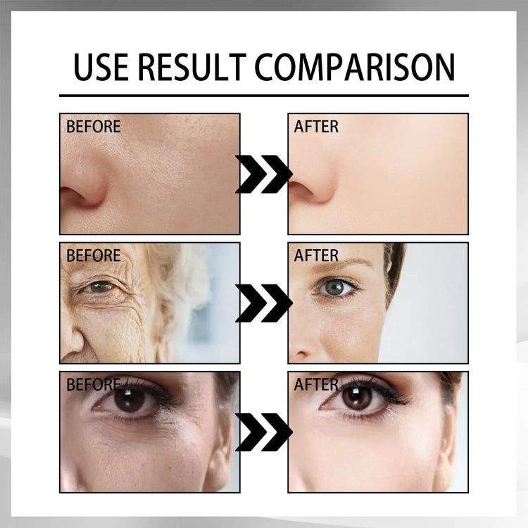 Snail Cream Fading Wrinkle French Lines Replenishment Firming Skin Anti-Aging - Huy&
